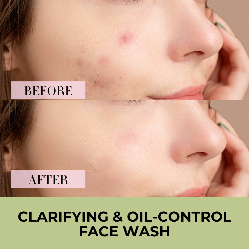 Tea Tree, Neem & Aloe Vera Face Wash - Acne & Oil Control