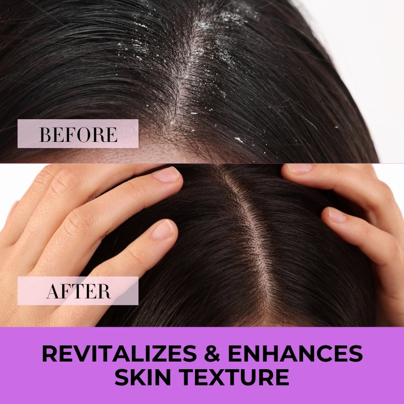 Anti-Dandruff + Keratin Shampoo with Conditioner