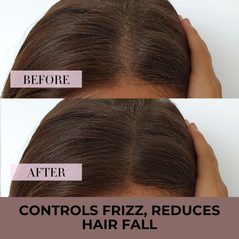 Best Biotin Shampoo